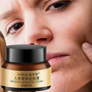 Creme concentrado herbal potente para remoção de acne
