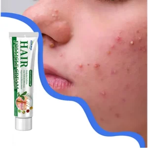 Tratamento facial suave para acne em 7 dias