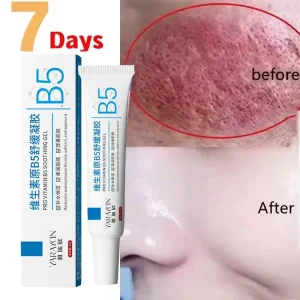 Creme reparador para vermelhidão facial