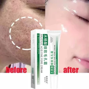 Creme para reduzir os poros com ácido salicílico