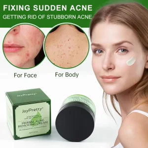 Creme facial herbal JoyPrettyin para acne
